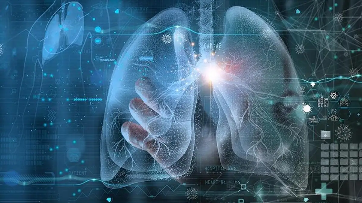 Illustration of lungs and mouth with bacteria