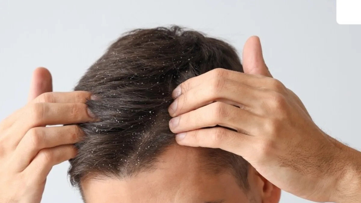 A person massaging their scalp