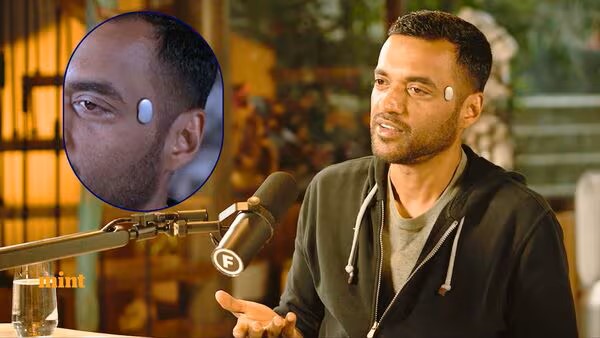 What’s the Device on Deepinder Goyal’s Temple? Viral Jokes, Real Science Explained