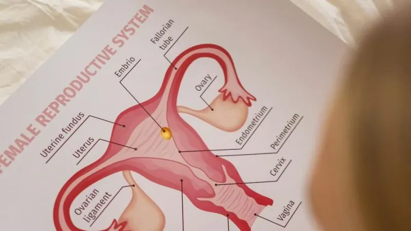 PCOS Renamed to PMOS: A New Era in Understanding Infertility - 24SevenUpdates